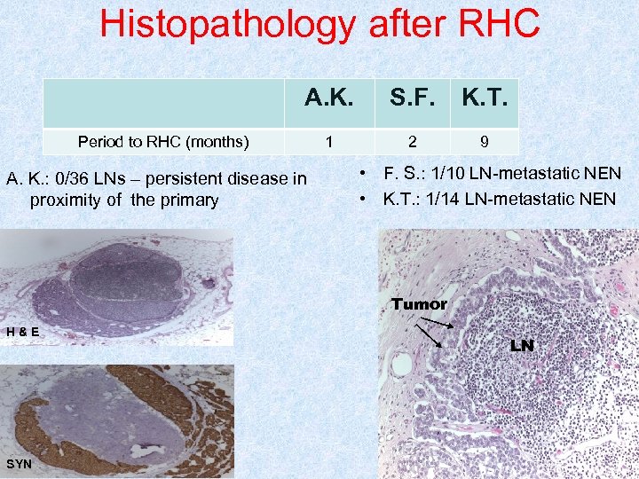 Histopathology after RHC A. K. S. F. K. T. 1 2 9 Period to