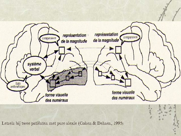 Letsels bij twee patiënten met pure alexie (Cohen & Dehaen, 1995) 
