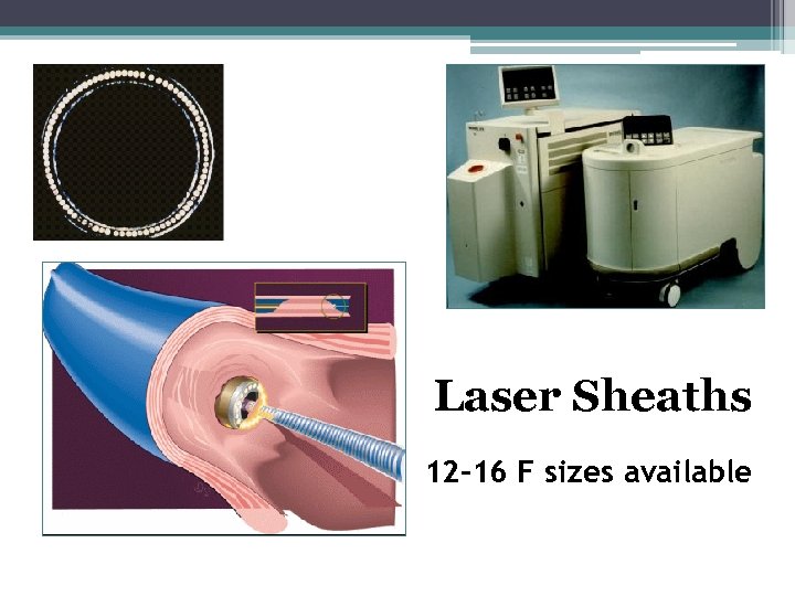 Laser Sheaths 12 -16 F sizes available 