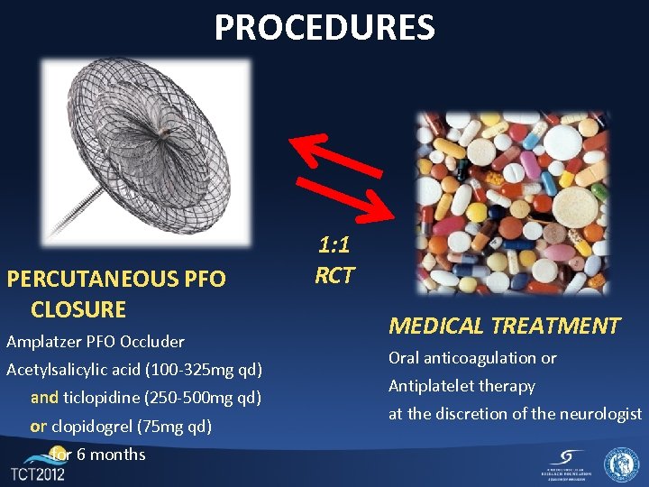 PROCEDURES PERCUTANEOUS PFO CLOSURE Amplatzer PFO Occluder Acetylsalicylic acid (100 -325 mg qd) and
