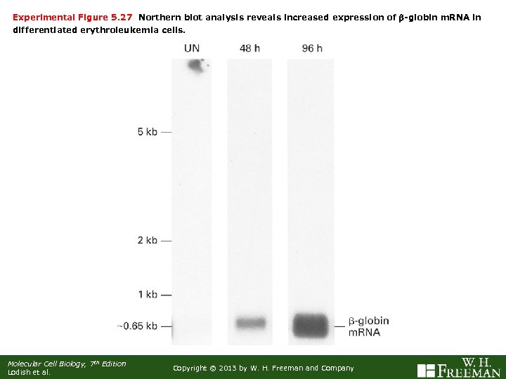 Experimental Figure 5. 27 Northern blot analysis reveals increased expression of b-globin m. RNA