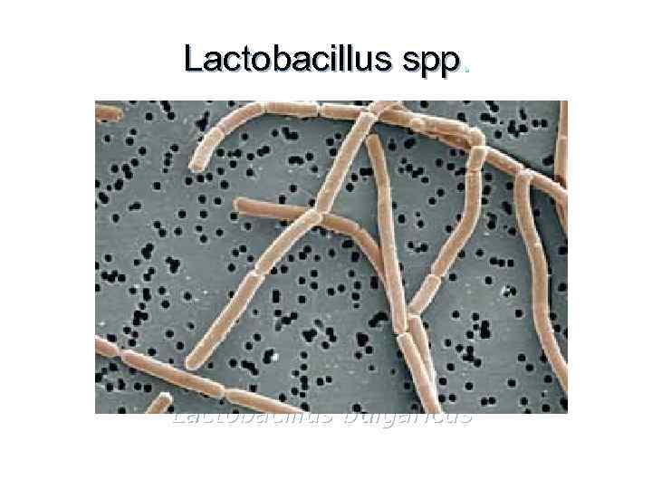 Lactobacillus spp у мужчин. Lactobacillus SP. Лактобацилус SPP. Lactobacillus SPP фото. Lactobacillus SPP микрофото.