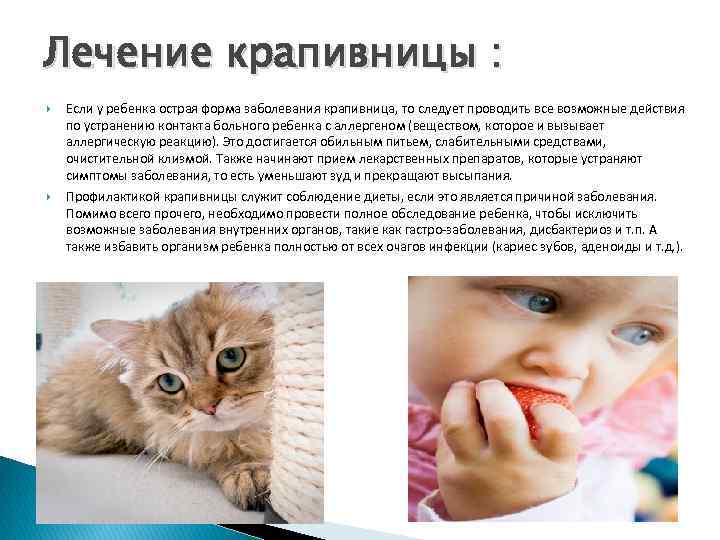 Лечение крапивницы : Если у ребенка острая форма заболевания крапивница, то следует проводить все