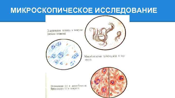 МИКРОСКОПИЧЕСКОЕ ИССЛЕДОВАНИЕ 
