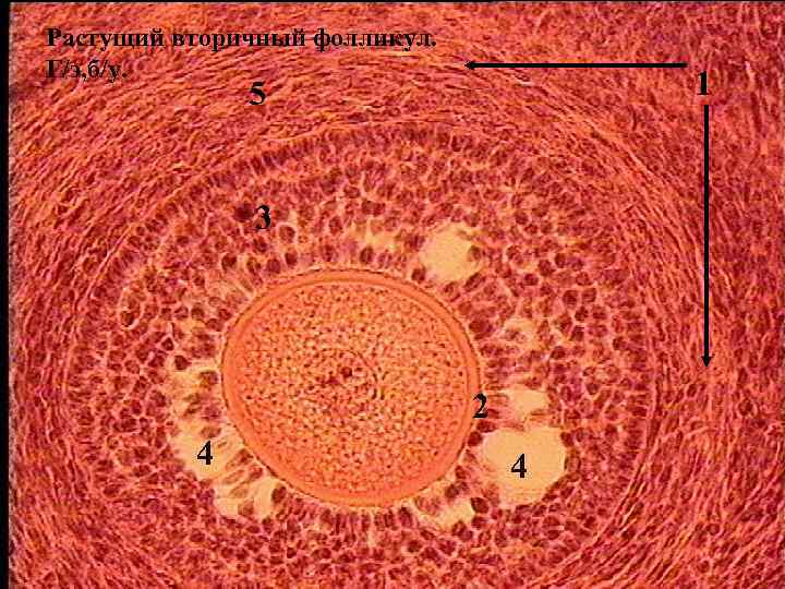Растущий вторичный фолликул. Г/э, б/у. 1 5 3 2 4 4 