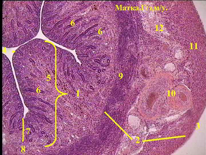 Матка. Г/э, м/у. 6 12 6 11 4 9 5 6 7 8 1