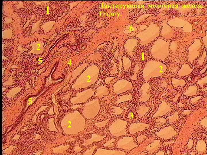 Лактирующая молочная железа. Г/э, м/у. 1 6 2 5 1 4 2 2 5
