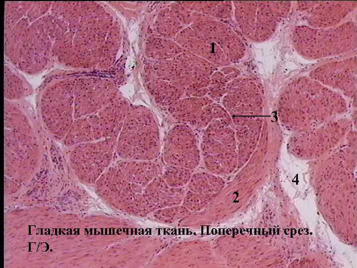 1 3 4 2 Гладкая мышечная ткань. Поперечный срез. Г/Э. 