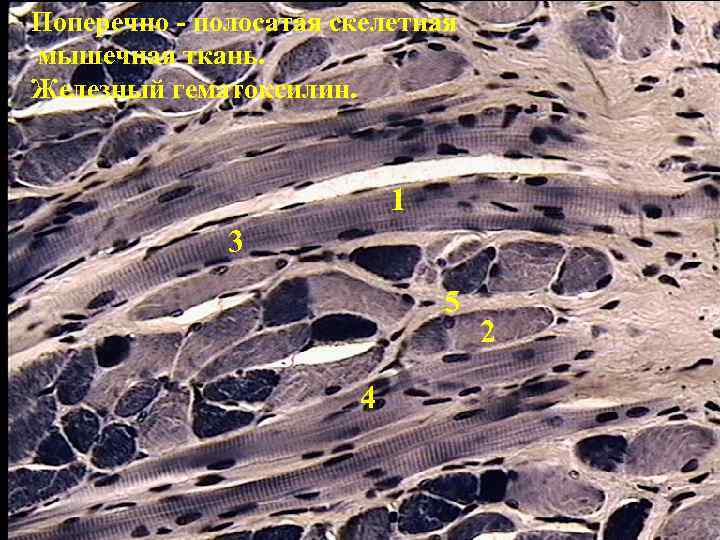 Поперечно - полосатая скелетная мышечная ткань. Железный гематоксилин. 1 3 5 4 2 