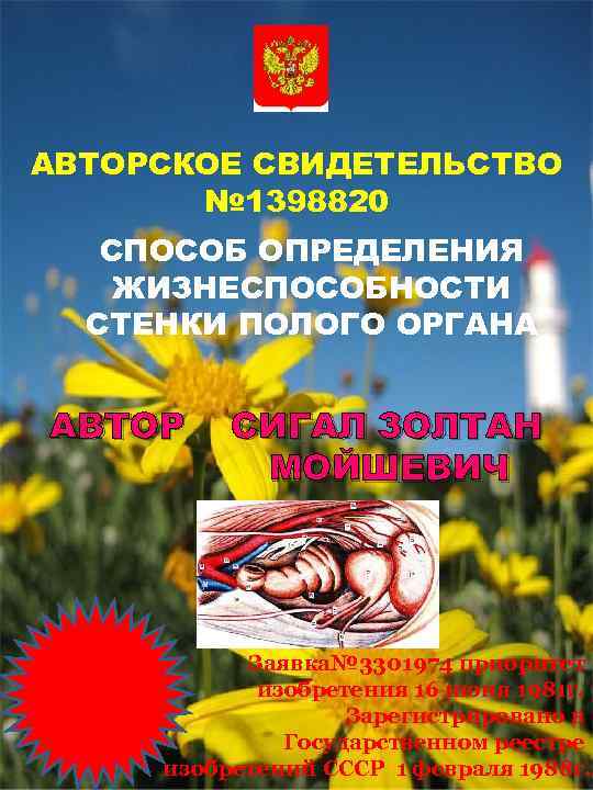 АВТОРСКОЕ СВИДЕТЕЛЬСТВО № 1398820 СПОСОБ ОПРЕДЕЛЕНИЯ ЖИЗНЕСПОСОБНОСТИ СТЕНКИ ПОЛОГО ОРГАНА АВТОР СИГАЛ ЗОЛТАН МОЙШЕВИЧ