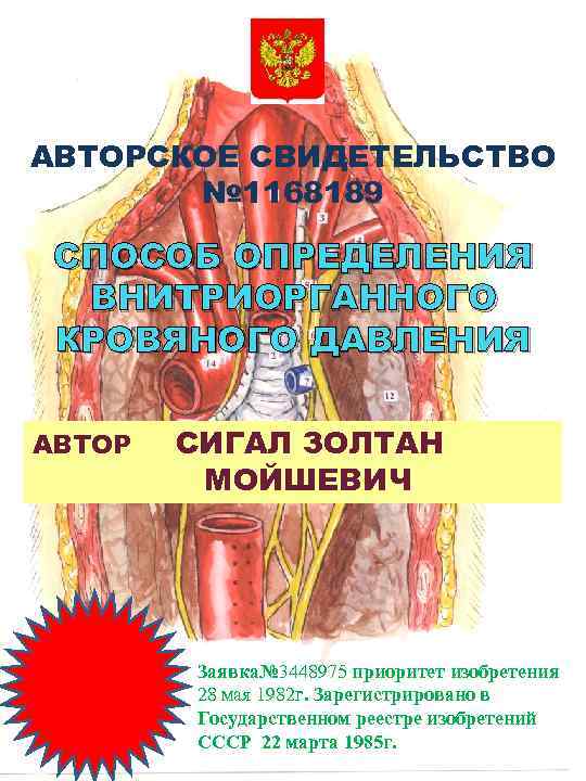 АВТОРСКОЕ СВИДЕТЕЛЬСТВО № 1168189 СПОСОБ ОПРЕДЕЛЕНИЯ ВНИТРИОРГАННОГО КРОВЯНОГО ДАВЛЕНИЯ АВТОР СИГАЛ ЗОЛТАН МОЙШЕВИЧ Заявка№
