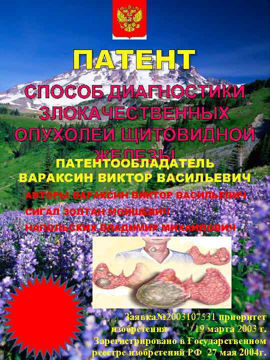 ПАТЕНТ СПОСОБ ДИАГНОСТИКИ ЗЛОКАЧЕСТВЕННЫХ ОПУХОЛЕЙ ЩИТОВИДНОЙ ЖЕЛЕЗЫ ПАТЕНТООБЛАДАТЕЛЬ ВАРАКСИН ВИКТОР ВАСИЛЬЕВИЧ АВТОРЫ ВАРАКСИН ВИКТОР