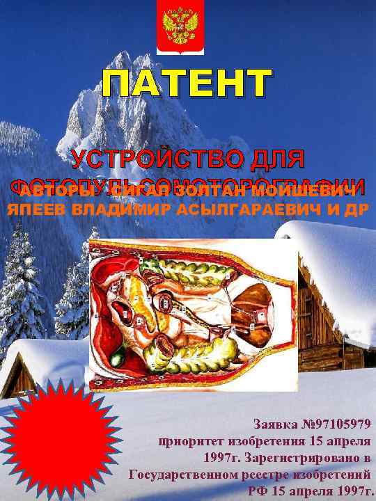ПАТЕНТ УСТРОЙСТВО ДЛЯ ФОТОПУЛЬСОМОТОРОГРАФИИ АВТОРЫ СИГАЛ ЗОЛТАН МОЙШЕВИЧ ЯПЕЕВ ВЛАДИМИР АСЫЛГАРАЕВИЧ И ДР Заявка