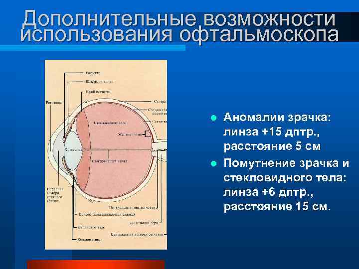 Дополнительные возможности использования офтальмоскопа Аномалии зрачка: линза +15 дптр. , расстояние 5 см l