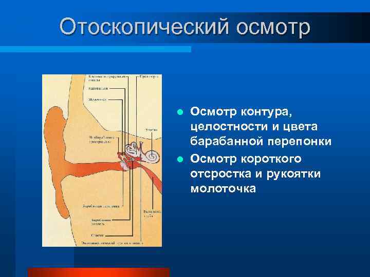 Отоскопический осмотр Осмотр контура, целостности и цвета барабанной перепонки l Осмотр короткого отсростка и