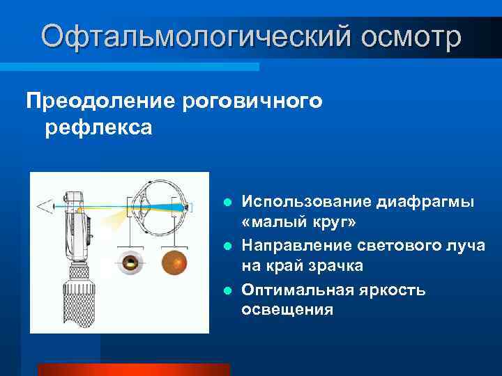 Офтальмологический осмотр Преодоление роговичного рефлекса Использование диафрагмы «малый круг» l Направление светового луча на