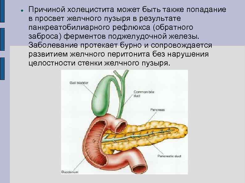  Причиной холецистита может быть также попадание в просвет желчного пузыря в результате панкреатобилиарного