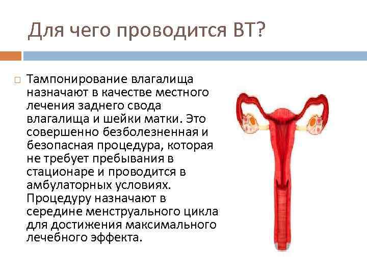 Для чего проводится ВТ? Тампонирование влагалища назначают в качестве местного лечения заднего свода влагалища