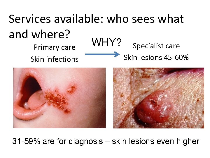 Services available: who sees what and where? Primary care Skin infections WHY? Specialist care