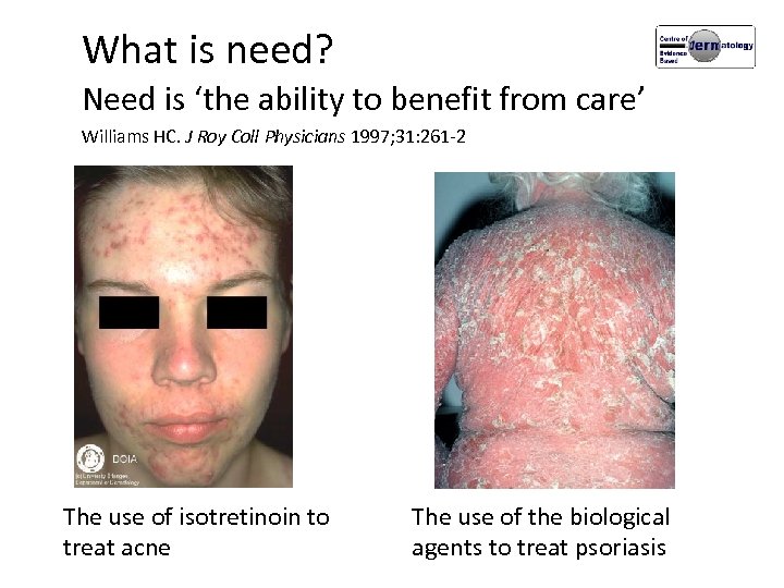 What is need? Need is ‘the ability to benefit from care’ Williams HC. J