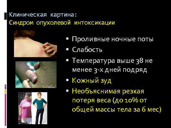 Клиническая картина: Синдром опухолевой интоксикации Проливные ночные поты Слабость Температура выше 38 не менее