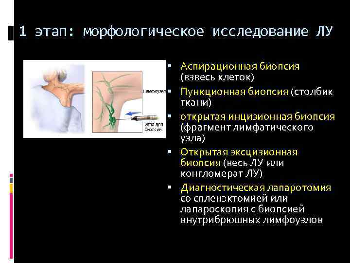 1 этап: морфологическое исследование ЛУ Аспирационная биопсия (взвесь клеток) Пункционная биопсия (столбик ткани) открытая