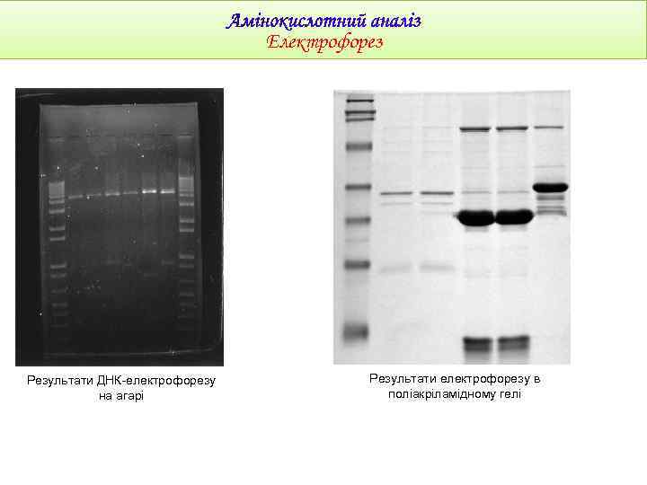 Електрофорез Результати ДНК-електрофорезу на агарі Результати електрофорезу в поліакріламідному гелі 