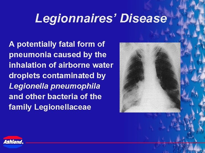 Legionnaires’ Disease A potentially fatal form of pneumonia caused by the inhalation of airborne