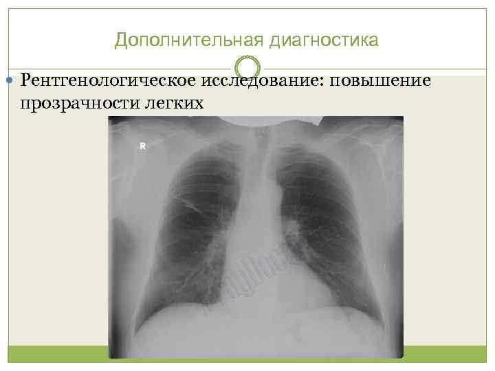 Дополнительная диагностика Рентгенологическое исследование: повышение прозрачности легких 