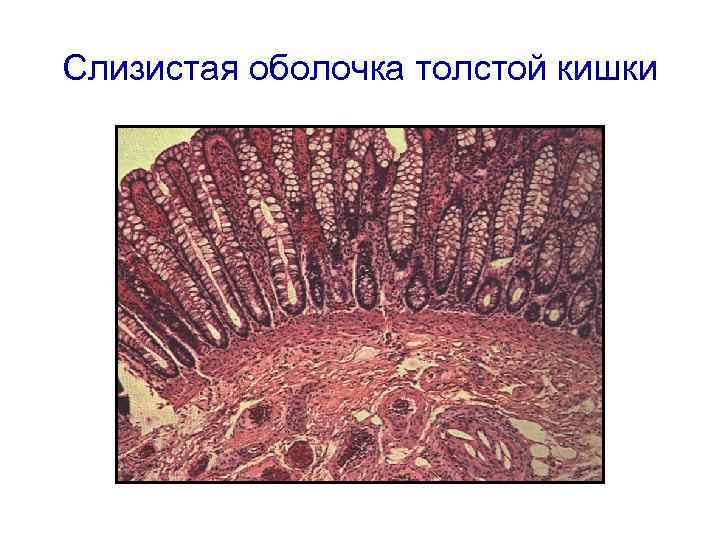 Слизистая оболочка толстой кишки 