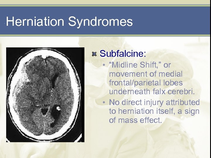 Herniation Syndromes Subfalcine: • “Midline Shift, ” or movement of medial frontal/parietal lobes underneath
