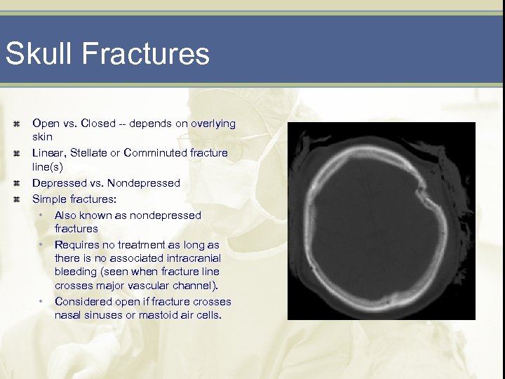 Skull Fractures Open vs. Closed -- depends on overlying skin Linear, Stellate or Comminuted