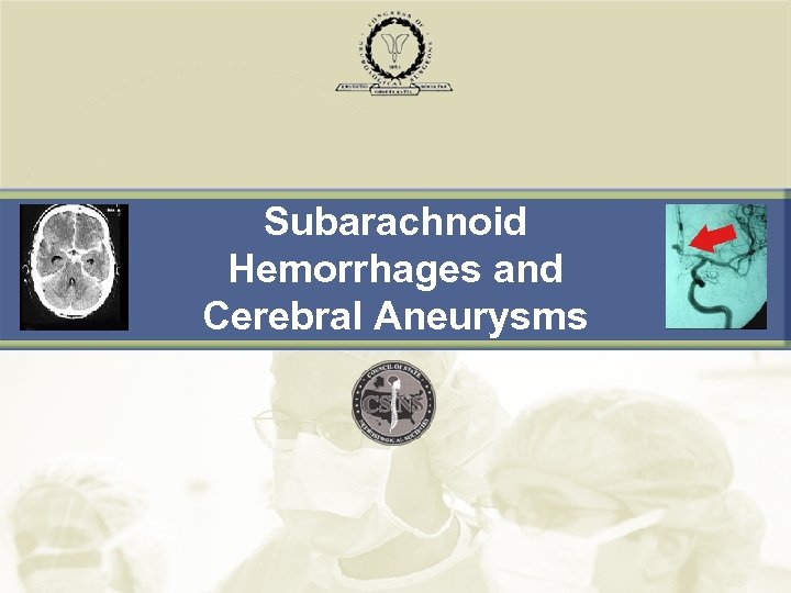 Subarachnoid Hemorrhages and Cerebral Aneurysms 
