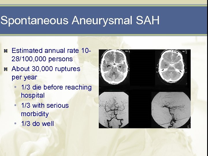 Spontaneous Aneurysmal SAH Estimated annual rate 1028/100, 000 persons About 30, 000 ruptures per