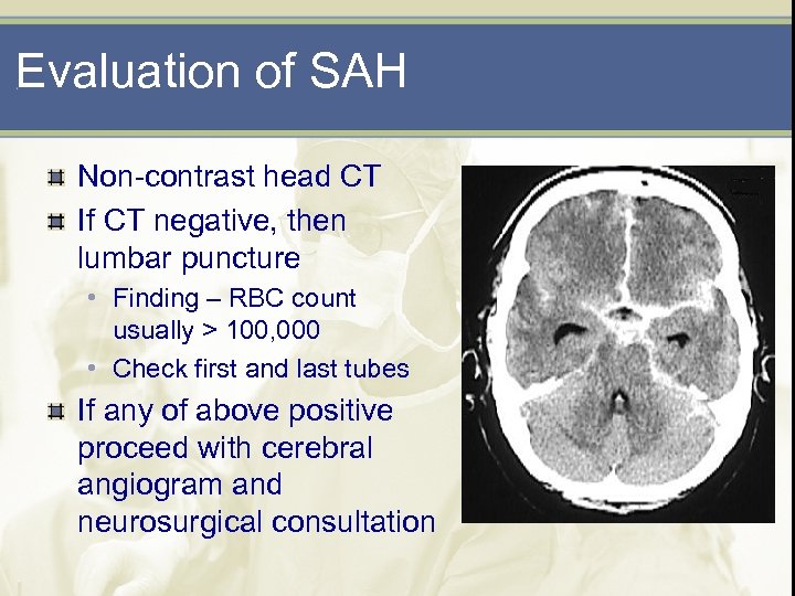 Evaluation of SAH Non-contrast head CT If CT negative, then lumbar puncture • Finding