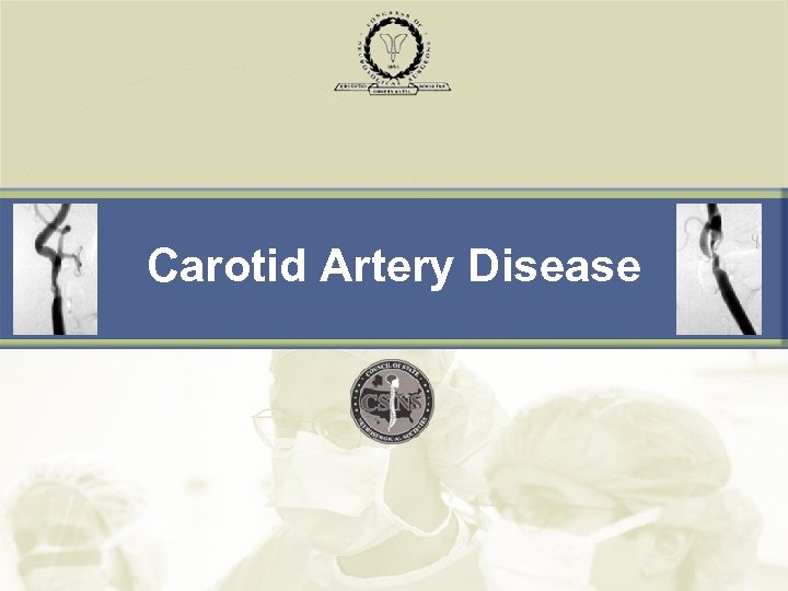 Carotid Artery Disease 