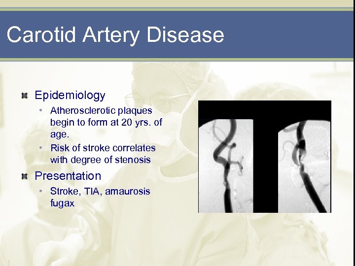 Carotid Artery Disease Epidemiology • Atherosclerotic plaques begin to form at 20 yrs. of