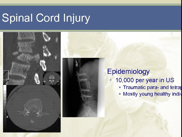 Spinal Cord Injury Epidemiology • 10, 000 per year in US § Traumatic para-