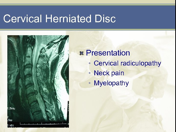 Cervical Herniated Disc Presentation • Cervical radiculopathy • Neck pain • Myelopathy 