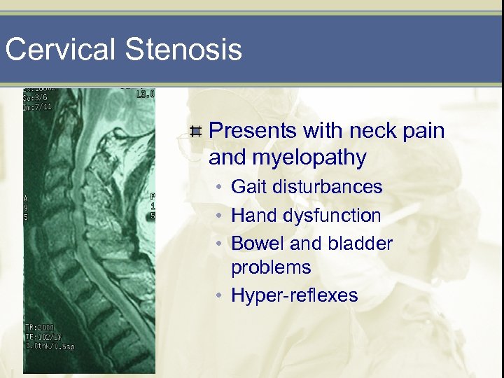 Cervical Stenosis Presents with neck pain and myelopathy • Gait disturbances • Hand dysfunction