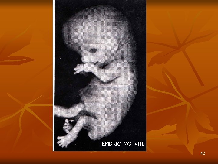 EMBRIO MG. VIII 42 