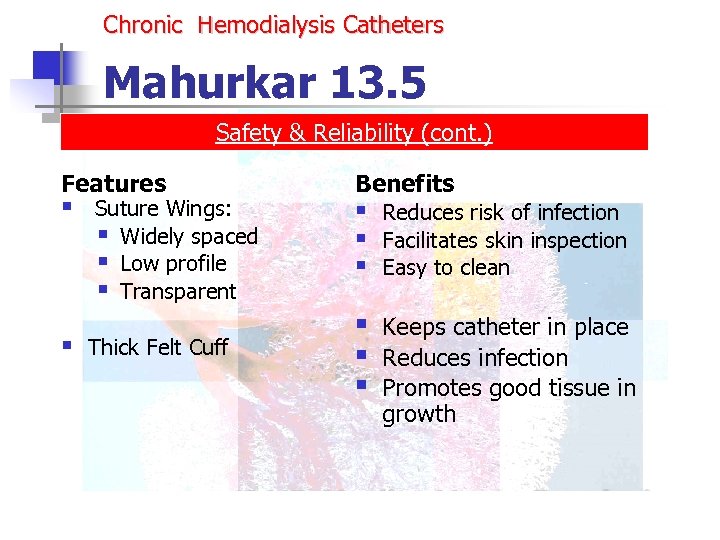 Chronic Hemodialysis Catheters Mahurkar 13. 5 Safety & Reliability (cont. ) Features § §