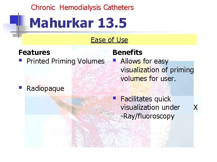 Chronic Hemodialysis Catheters Mahurkar 13. 5 Ease of Use Features § Printed Priming Volumes