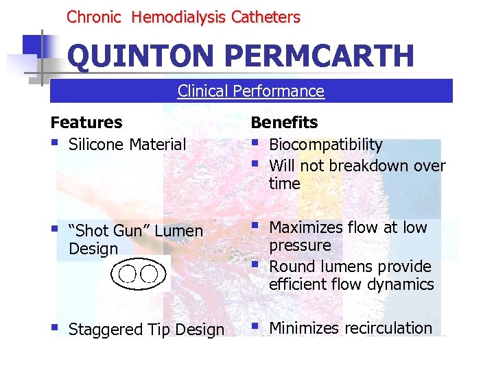 Chronic Hemodialysis Catheters QUINTON PERMCARTH Clinical Performance Features § Silicone Material Benefits § Biocompatibility
