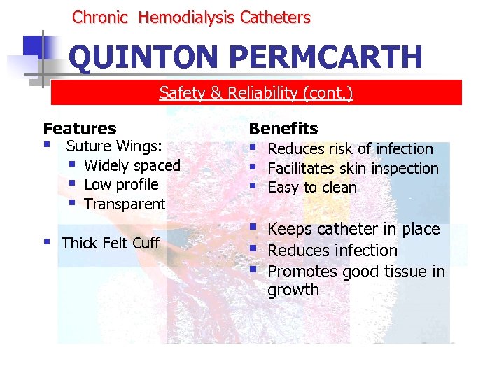 Chronic Hemodialysis Catheters QUINTON PERMCARTH Safety & Reliability (cont. ) Features § § Suture