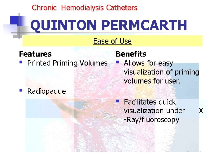 Chronic Hemodialysis Catheters QUINTON PERMCARTH Ease of Use Features § Printed Priming Volumes §