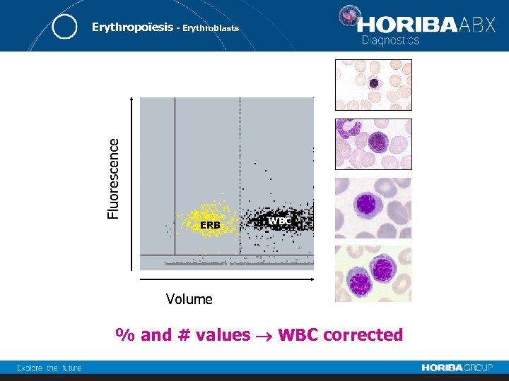 Fluorescence Erythropoïesis - Erythroblasts ERB WBC Volume % and # values WBC corrected 