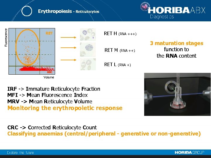 Fluorescence Erythropoïesis - Reticulocytes RET H (RNA +++) RET M RET L (RNA ++)