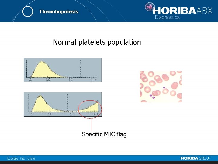Thrombopoïesis Normal platelets population Specific MIC flag 