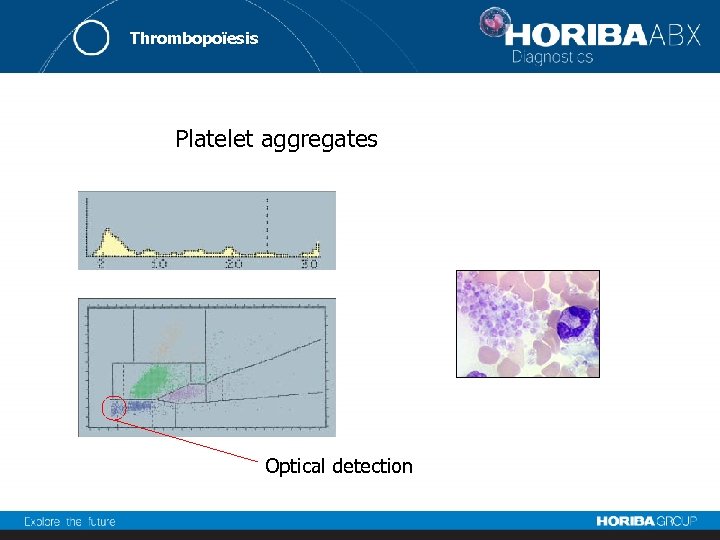 Thrombopoïesis Platelet aggregates Optical detection 